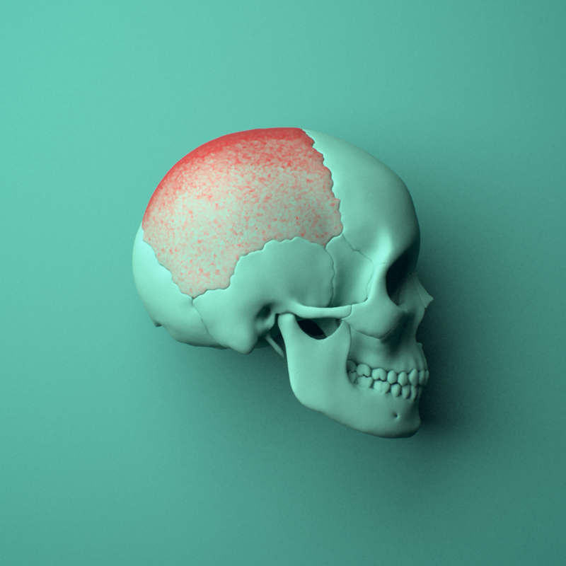A 3D model of a human skull on a solid teal background, with the upper cranium highlighted in red.