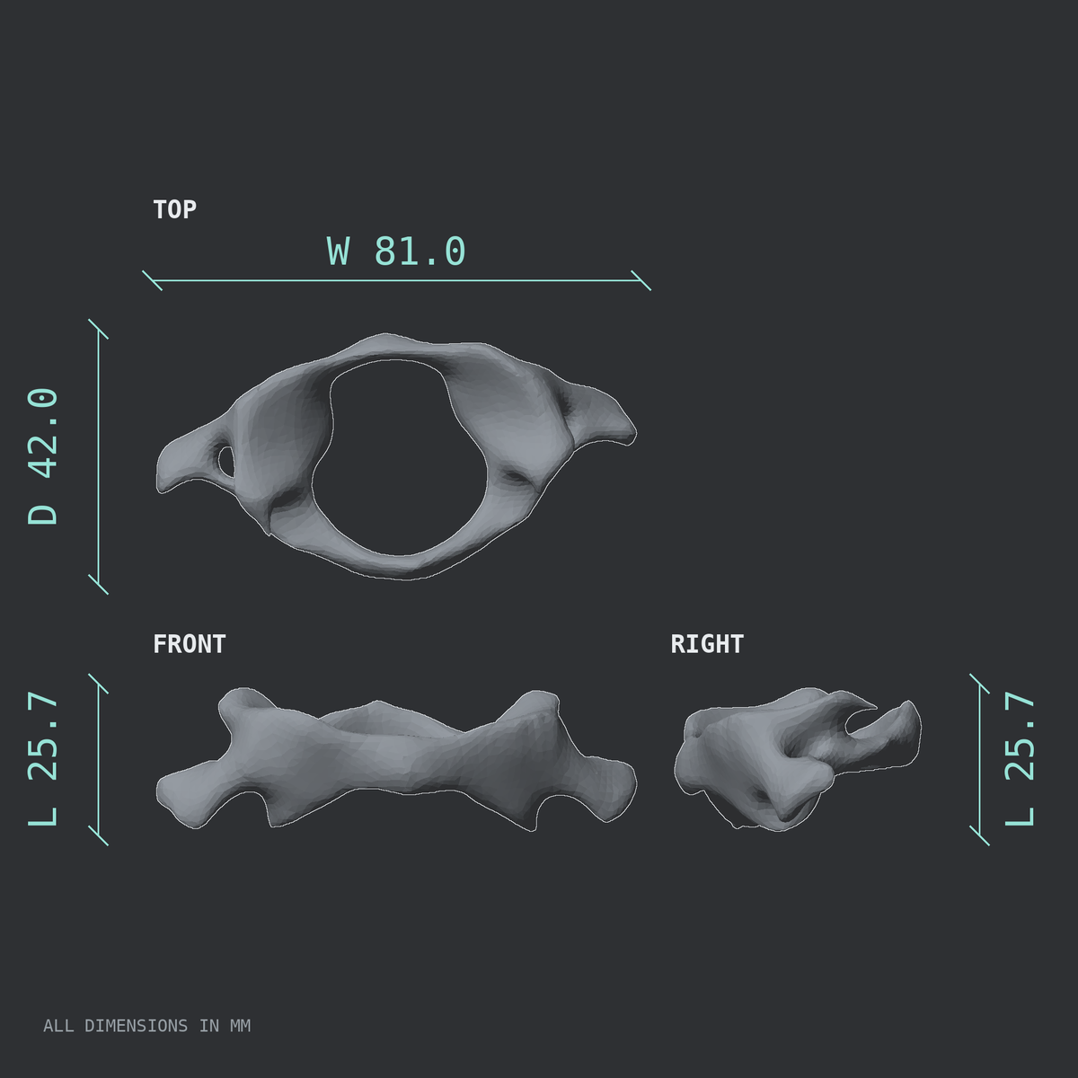 Dimensioned technical drawing of the C1 atlas vertebra, top, front, and side views.