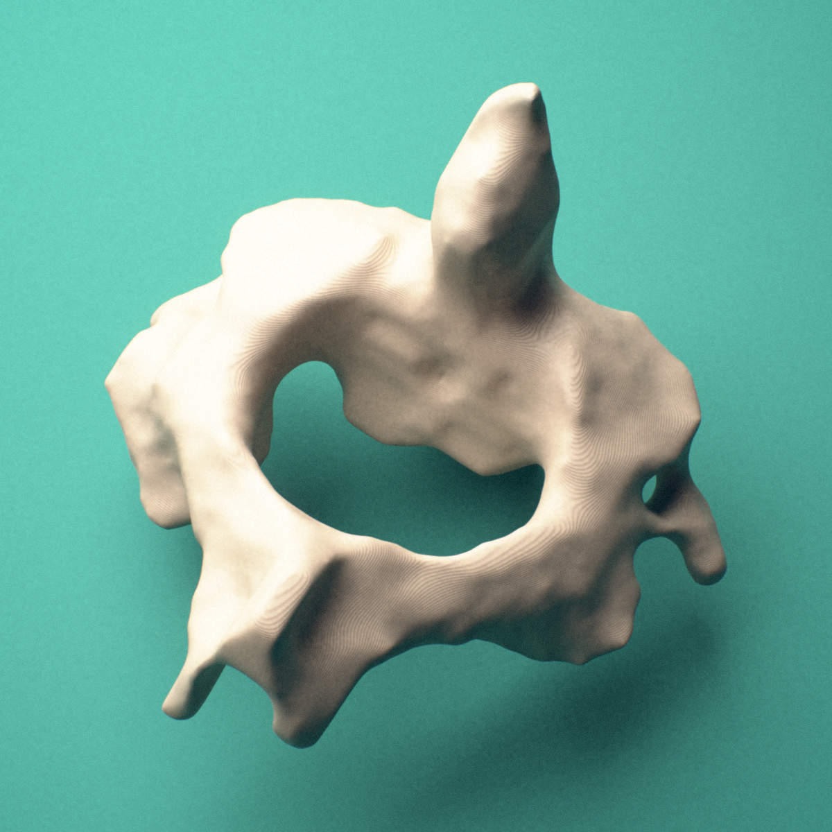 3D-printed C2 Axis cervical vertebra, superior view showing the dens, vertebral body, and vertebral foramen.