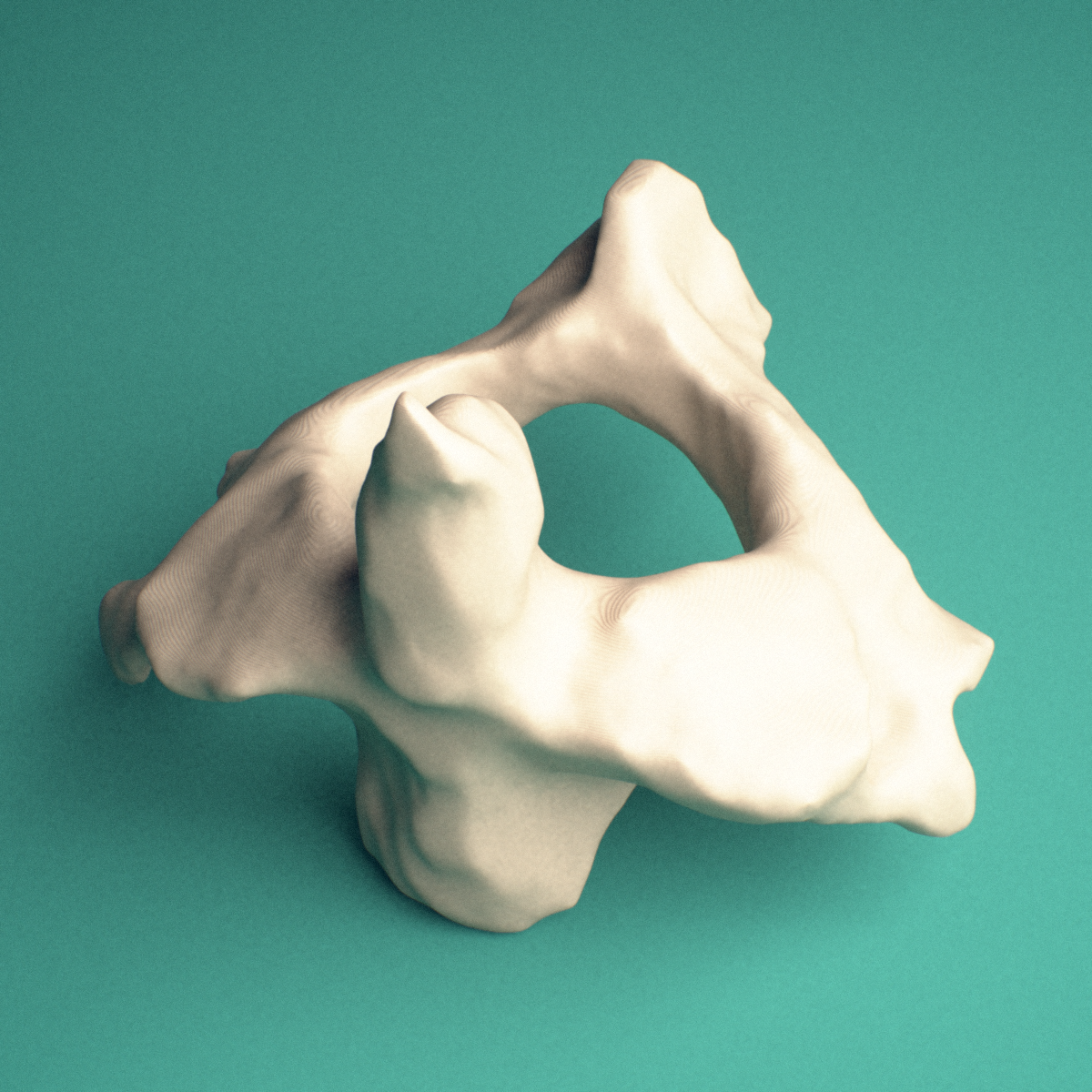 3D-printed C2 Axis cervical vertebra, posterior oblique view showing the bifid spinous process.