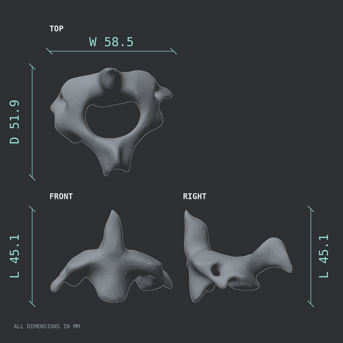 3D rendered dimensional drawing of the C2 Axis cervical vertebra, top, front, and side views.