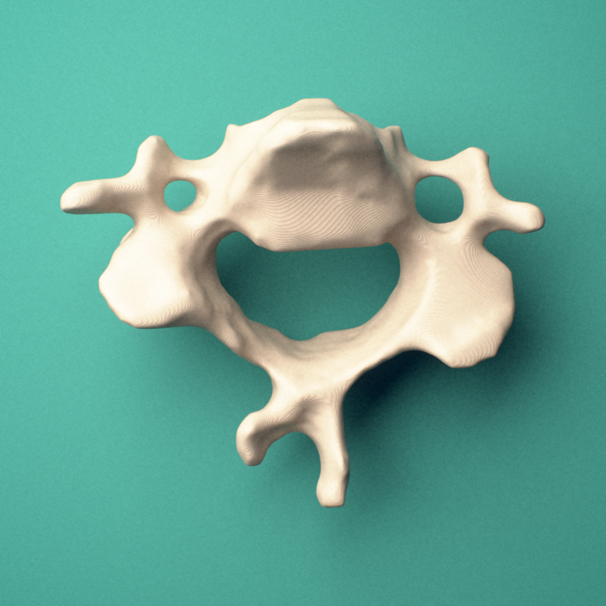 3D-printed C3 cervical vertebra, superior oblique view showing the superior articular facets and transverse foramina.