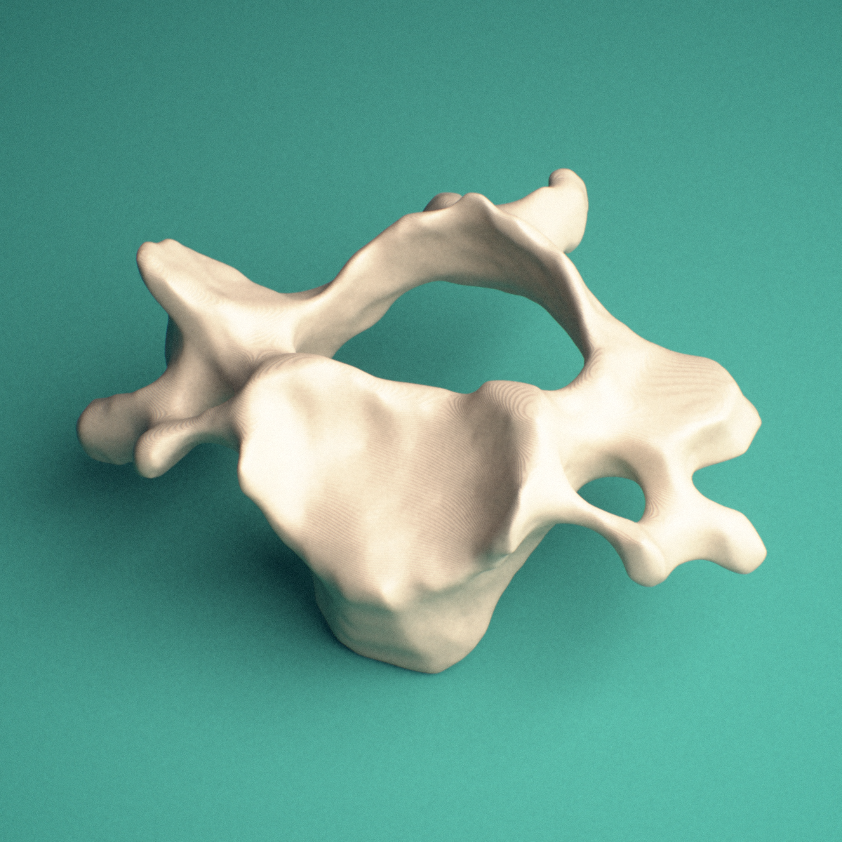 3D-printed C3 cervical vertebra, posterior view showing the bifid spinous process and transverse processes with transverse foramina.