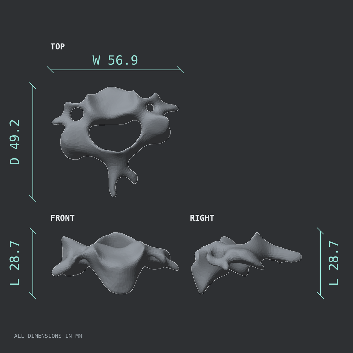 3D rendered dimensional drawing of the C3 cervical vertebra, top, front, and side views.