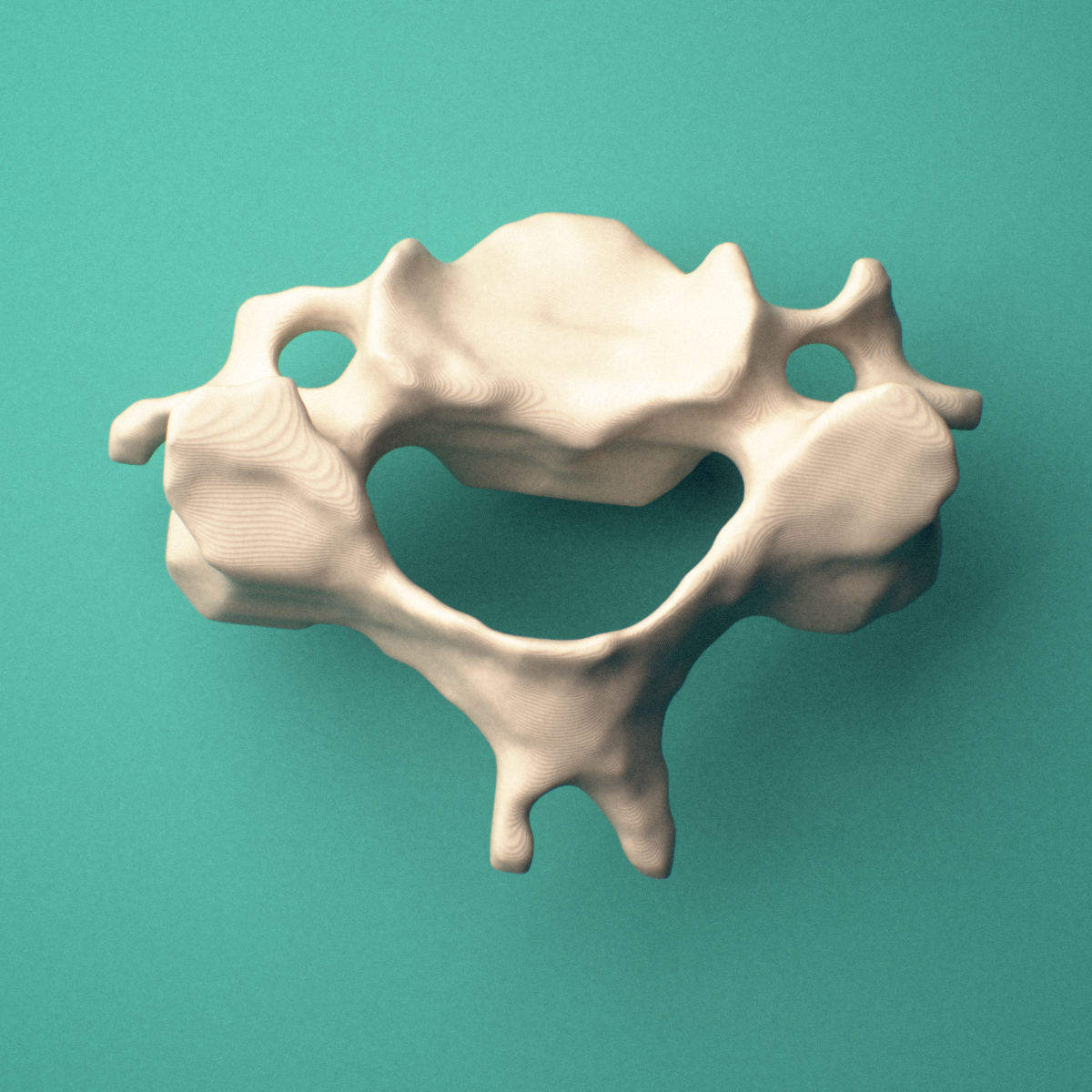 3D-printed C4 cervical vertebra, superior view showing the vertebral body, pedicles, and bifid spinous process.