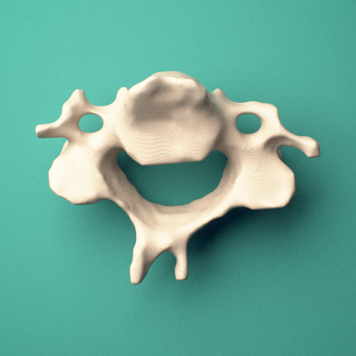 3D-printed C4 cervical vertebra, superior oblique view showing the superior articular facets and transverse foramina.