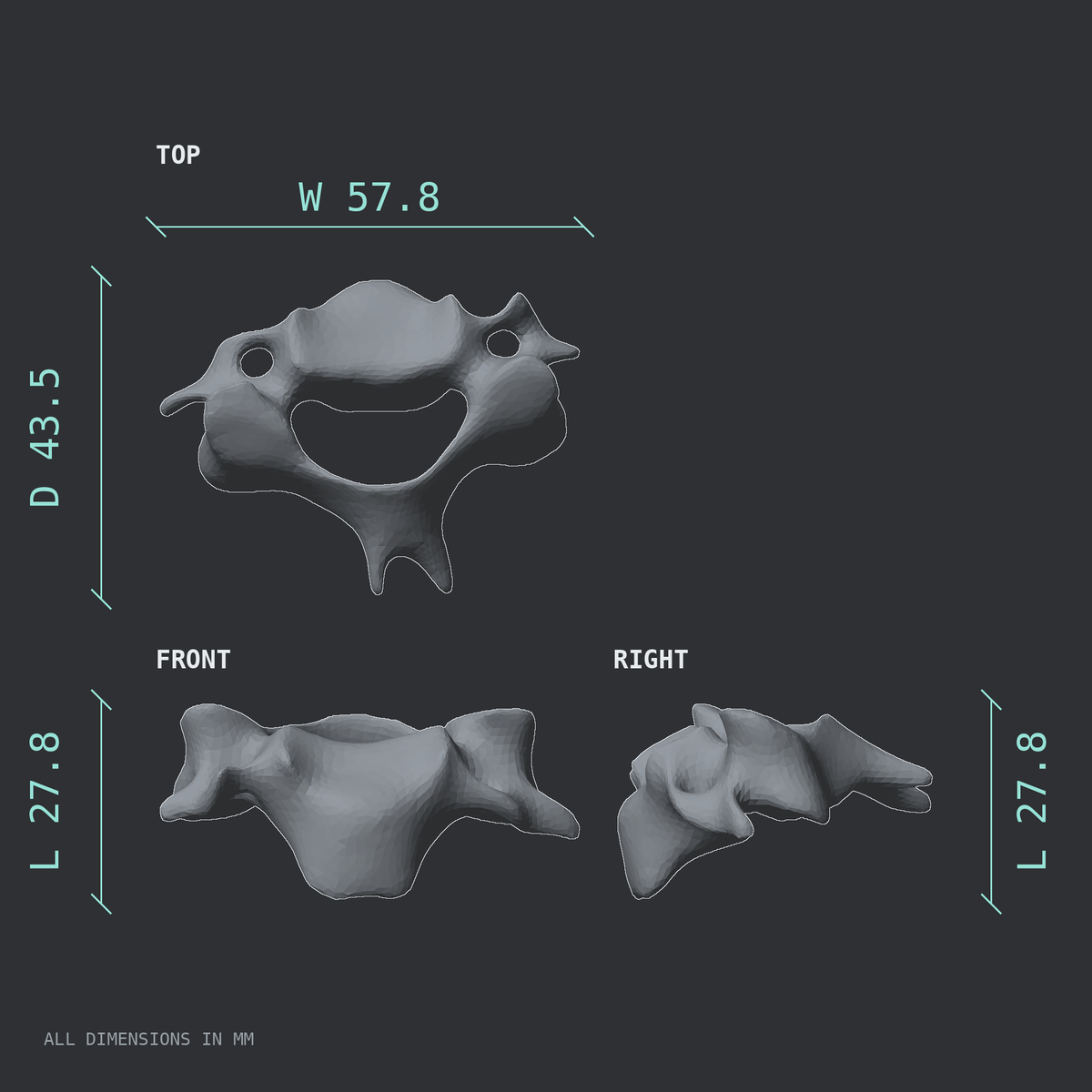 3D rendered dimensional drawing of the C4 cervical vertebra, top, front, and side views.