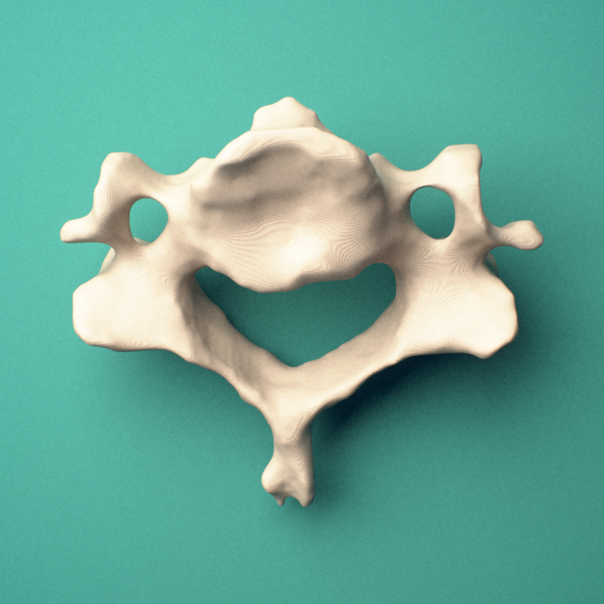 3D-printed C5 cervical vertebra, superior oblique view showing the superior articular facets and transverse foramina.