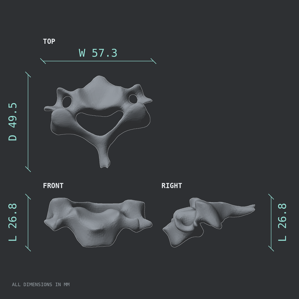 3D rendered dimensional drawing of the C5 cervical vertebra, top, front, and side views.