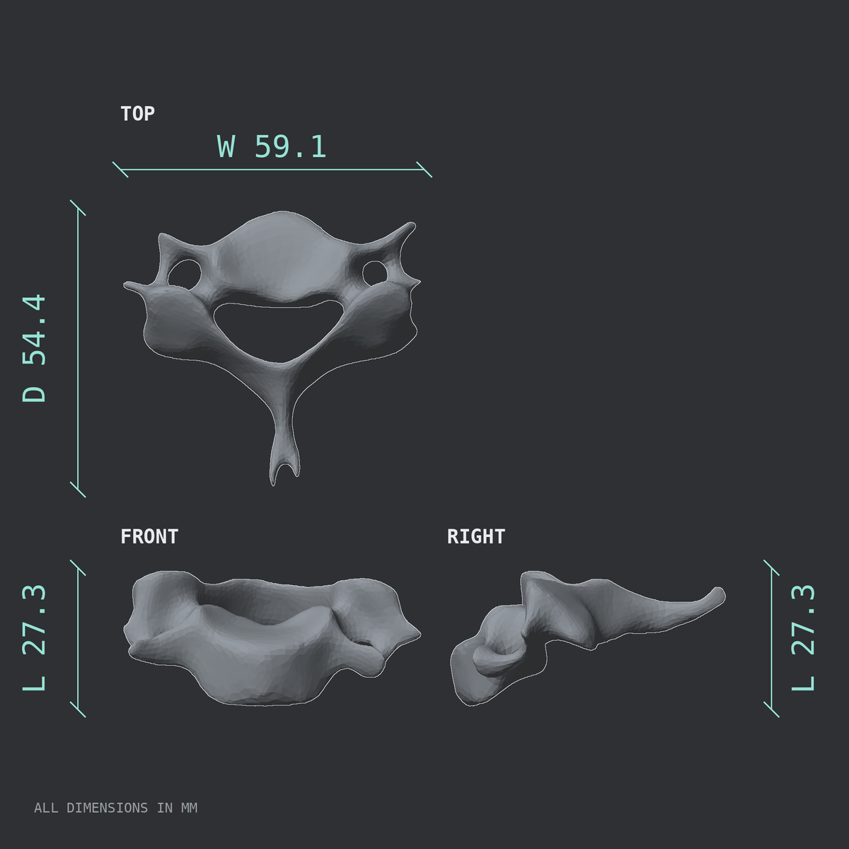 3D rendered dimensional drawing of the C6 cervical vertebra, top, front, and side views.