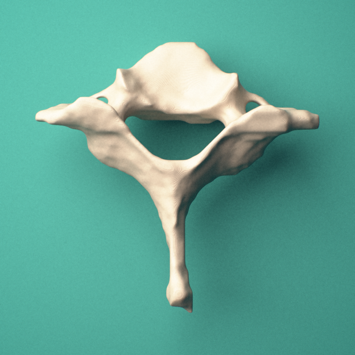 3D-printed C7 cervical vertebra, superior view showing the vertebral body and transverse foramina.