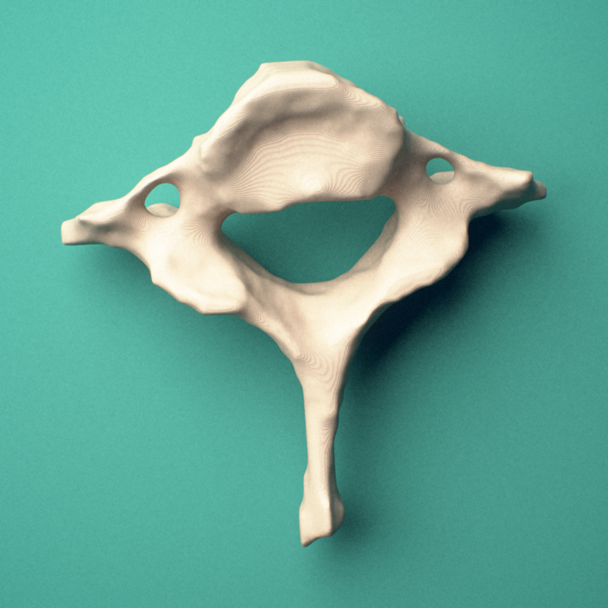 3D-printed C7 cervical vertebra, superior oblique view showing the superior articular facets and transverse foramina.