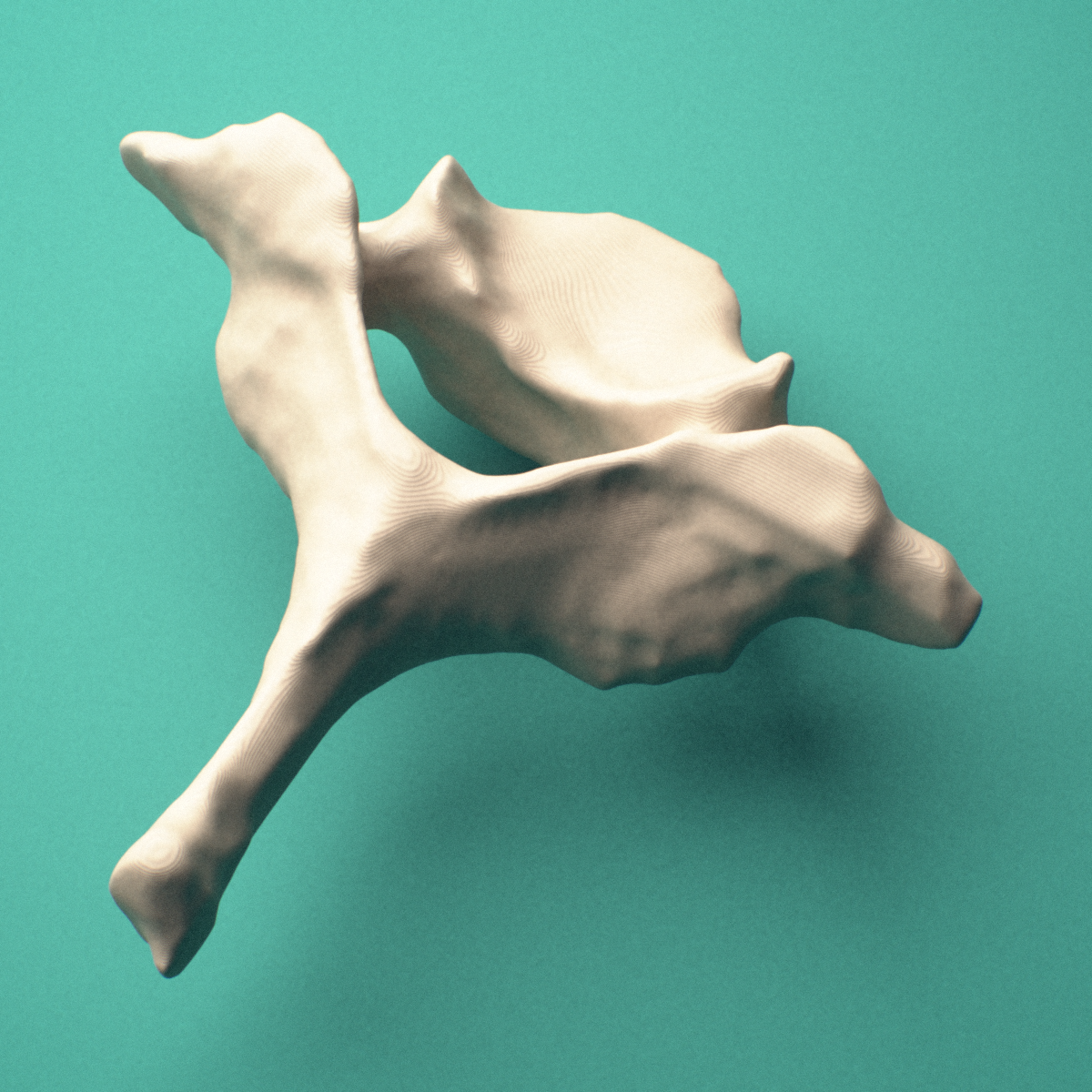 3D-printed C7 cervical vertebra, posterior oblique view showing the laminae and long spinous process (vertebra prominens).