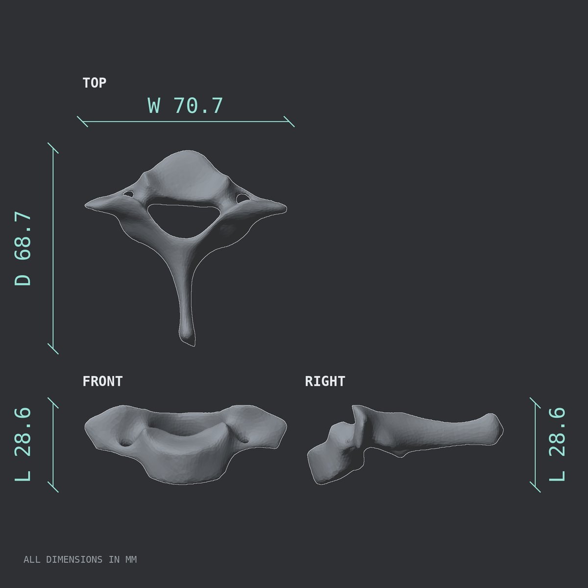 3D rendered dimensional drawing of the C7 cervical vertebra, top, front, and side views.