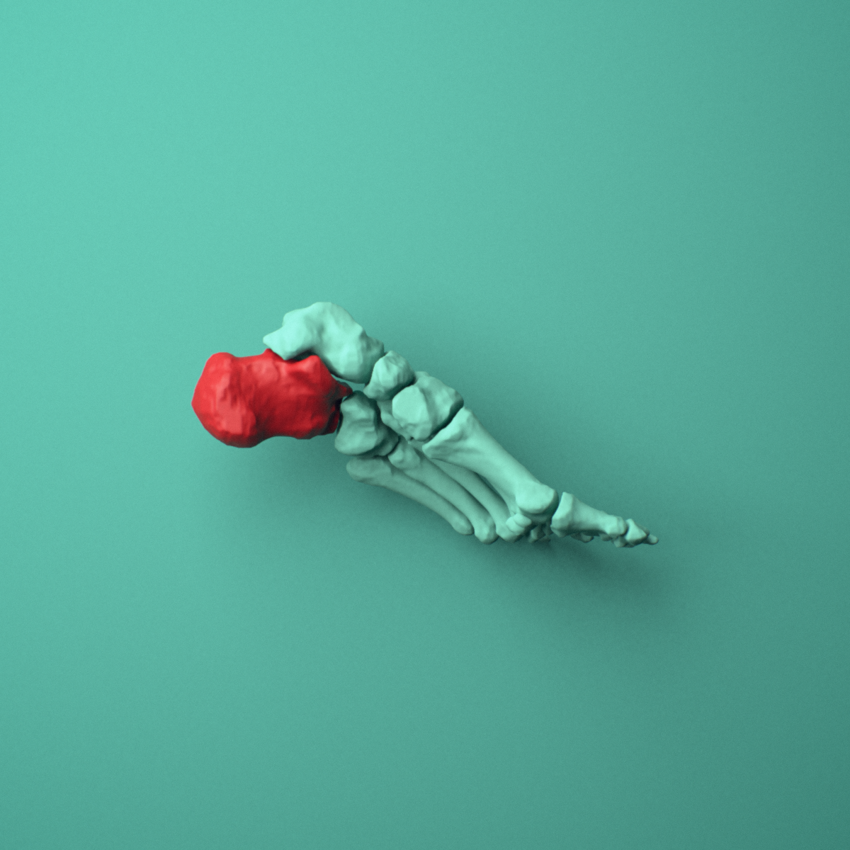3D model of the Left calcaneus (heel bone) shown in position within a full foot and ankle model, right lateral view.