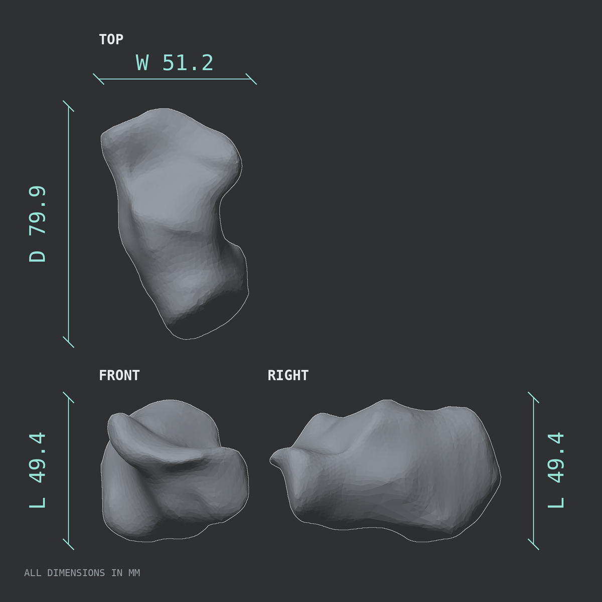 3D rendered dimensional drawing of the Left calcaneus (heel bone), top, front, and side views.