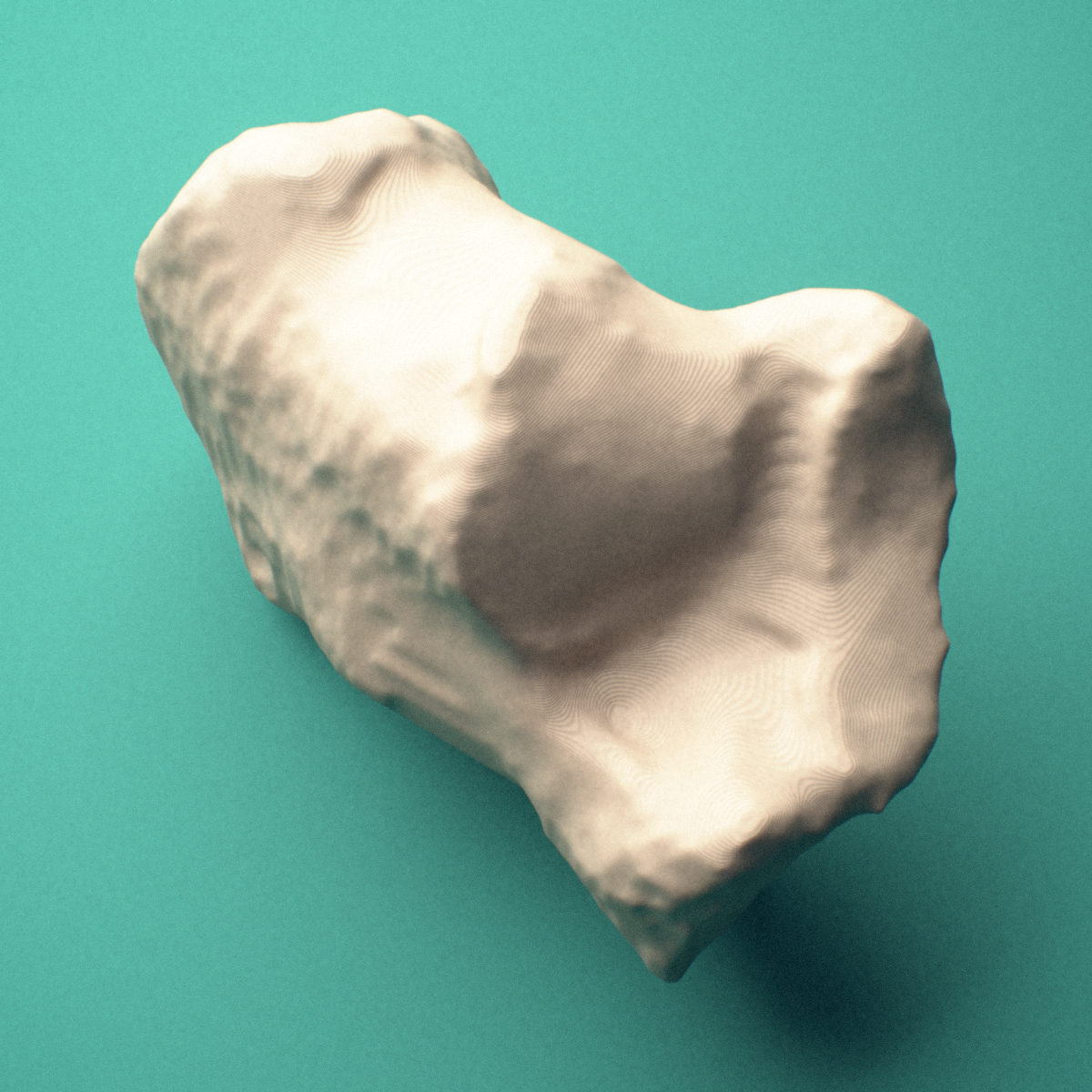 3D-printed Right calcaneus (heel bone), lateral view showing the peroneal trochlea.
