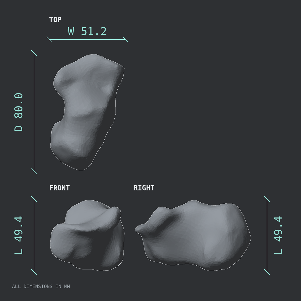 3D rendered dimensional drawing of the Right calcaneus (heel bone), top, front, and side views.
