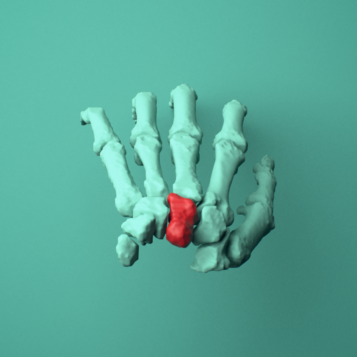 3D model of the Left capitate bone (wrist) shown in position within a full hand and wrist model, superior view.