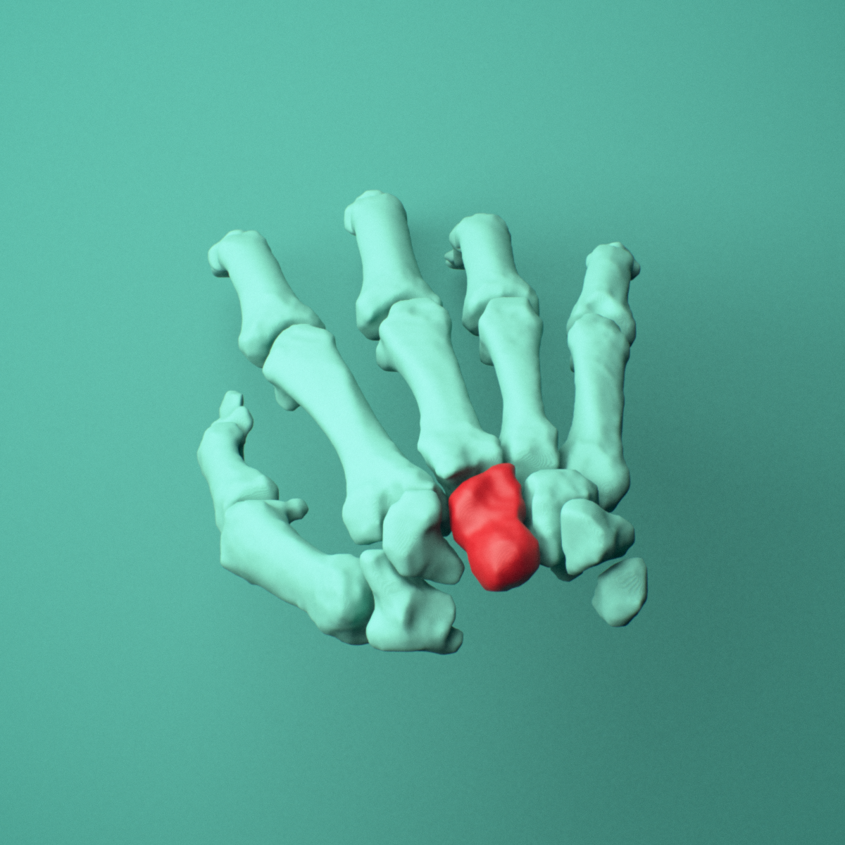 3D model of the Right capitate bone (wrist) shown in position within a full hand and wrist model, superior view.