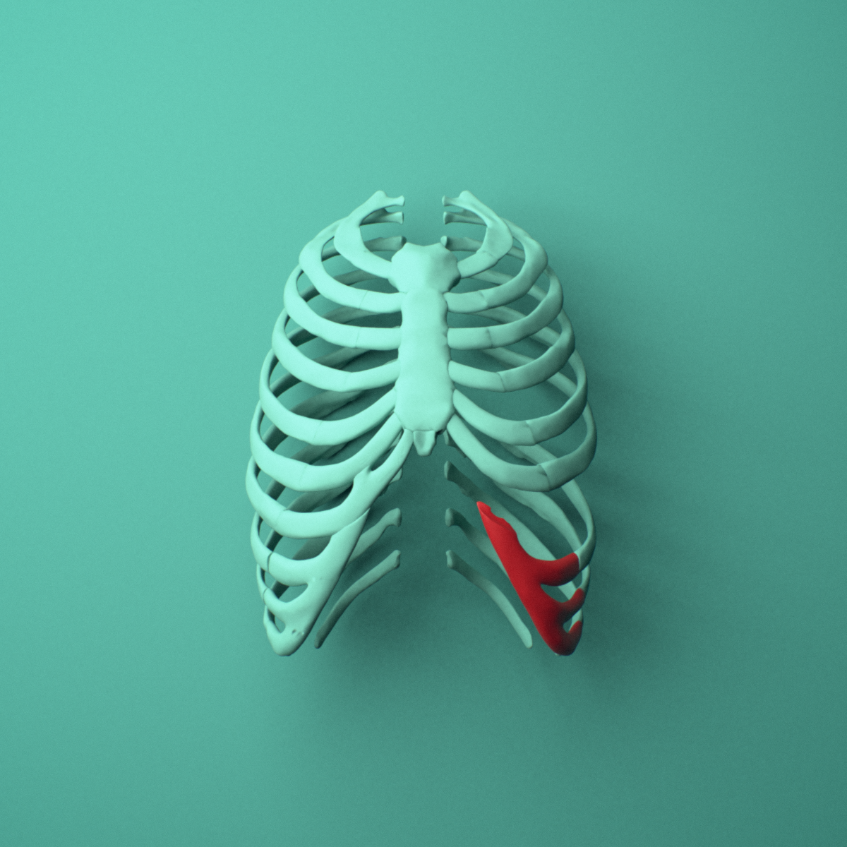 3D model of the Left costal cartilage shown in position within a full rib cage model, anterior view.