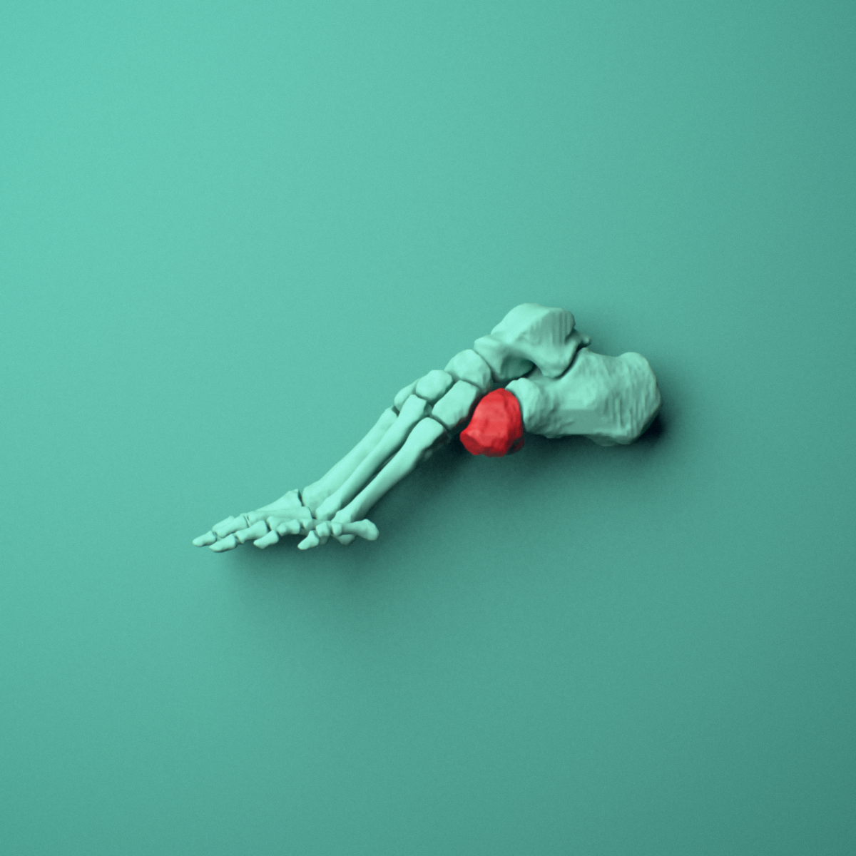 3D model of the Left cuboid bone (foot) shown in position within a full foot and ankle model, left lateral view.