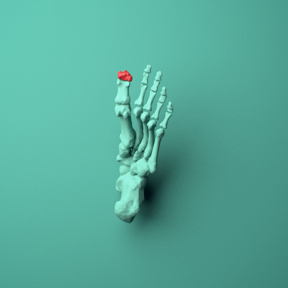 3D model of the Left big toe (hallux) distal phalanx shown in position within a full foot and ankle model, inferior view.