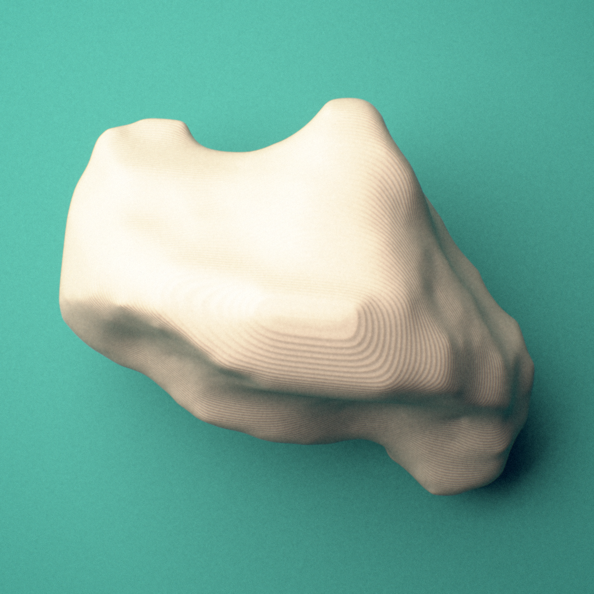 3D-printed Right big toe (hallux) distal phalanx, oblique view showing the base and head (trochlea).