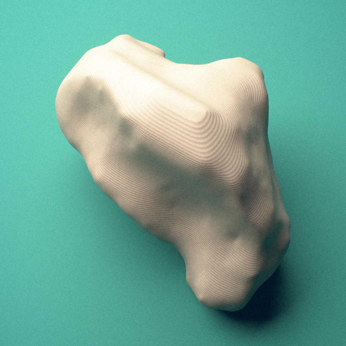 3D-printed Right big toe (hallux) distal phalanx, close-up view showing the head (trochlea).