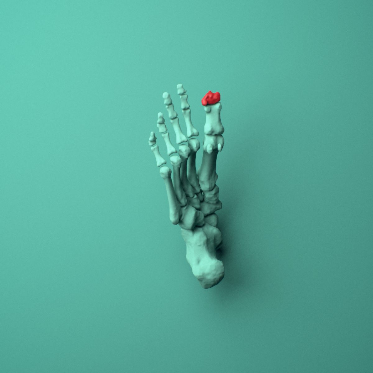 3D model of the Right big toe (hallux) distal phalanx shown in position within a full foot and ankle model, inferior view.