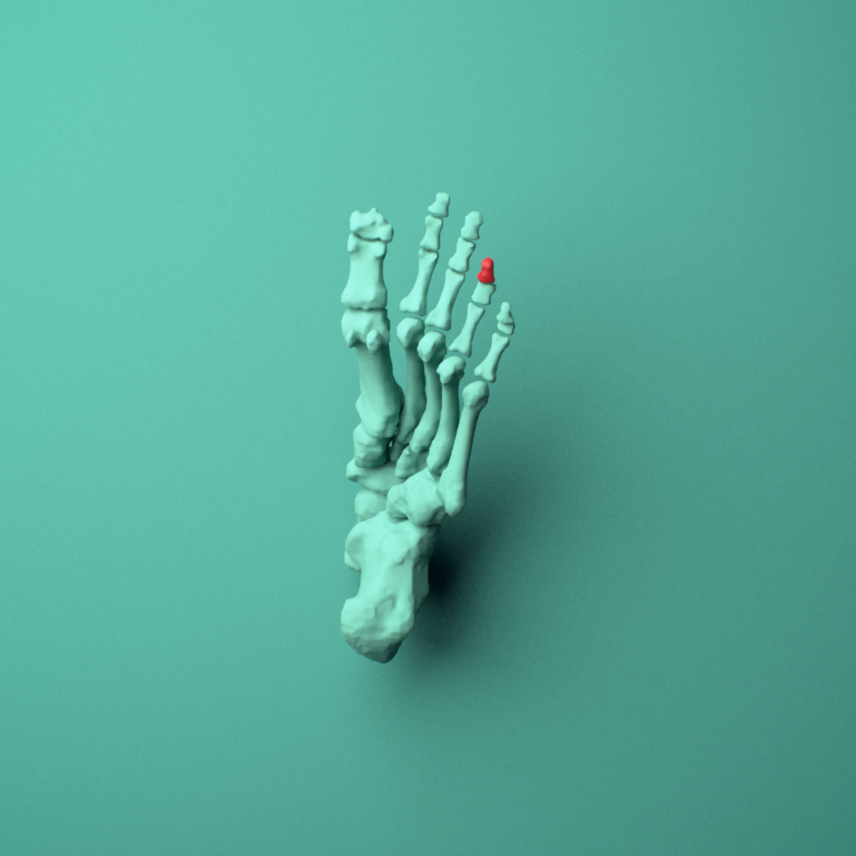 3D model of the Left fourth toe distal phalanx shown in position within a full foot and ankle model, inferior view.