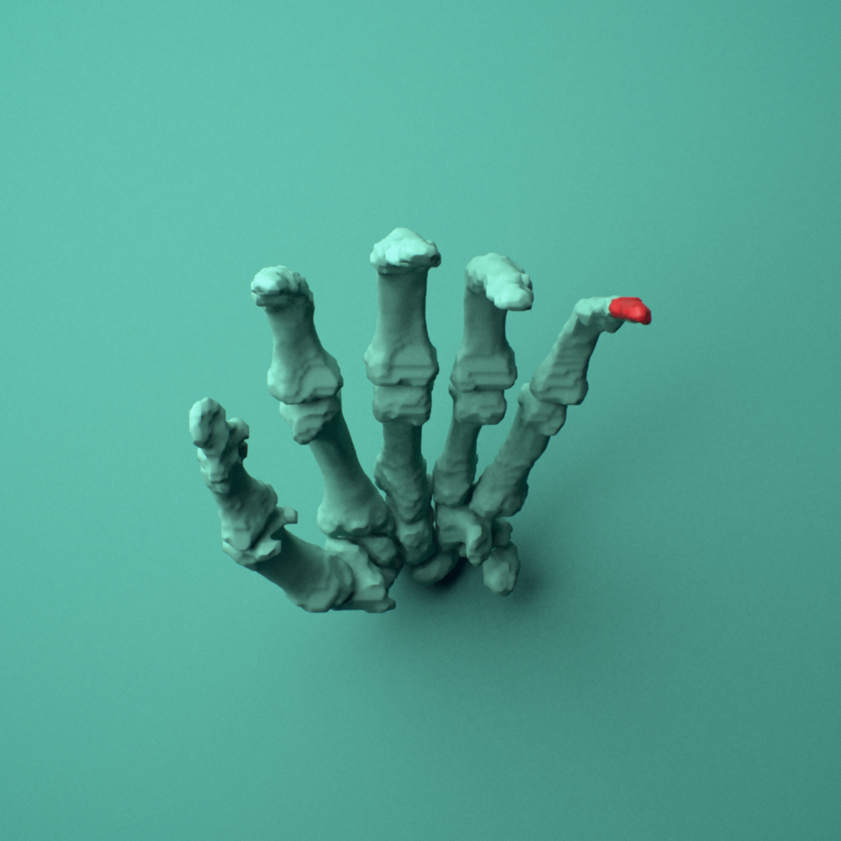 3D model of the Left little finger distal phalanx shown in position within a full hand and wrist model, inferior view.