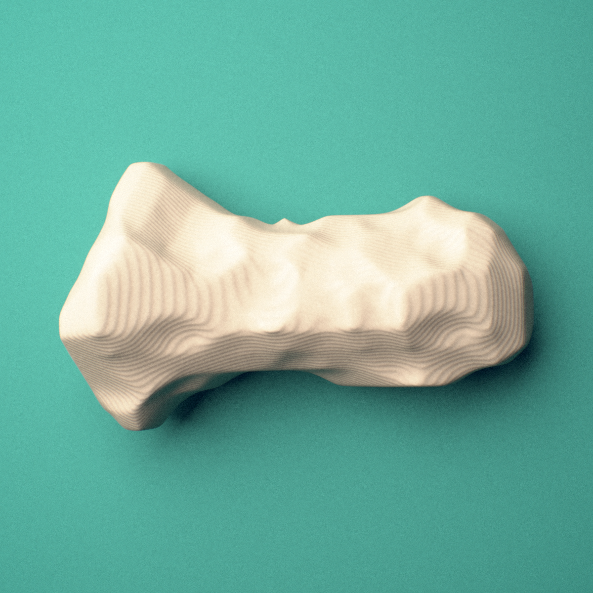 3D-printed Left middle finger distal phalanx, oblique view showing the base and head (trochlea).