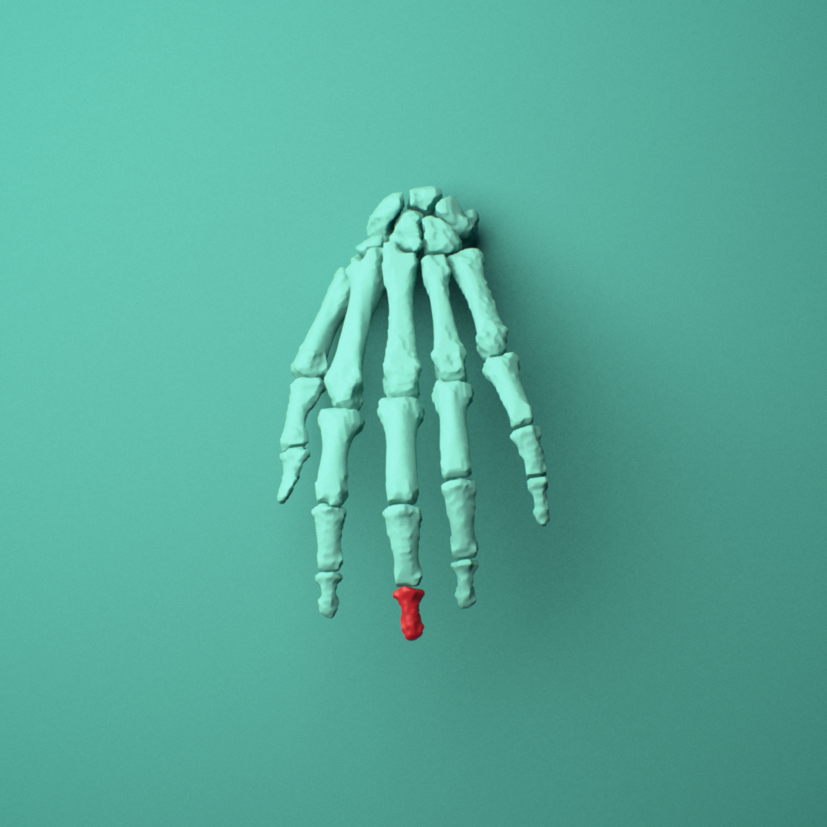 3D model of the Left middle finger distal phalanx shown in position within a full hand and wrist model, anterior view.