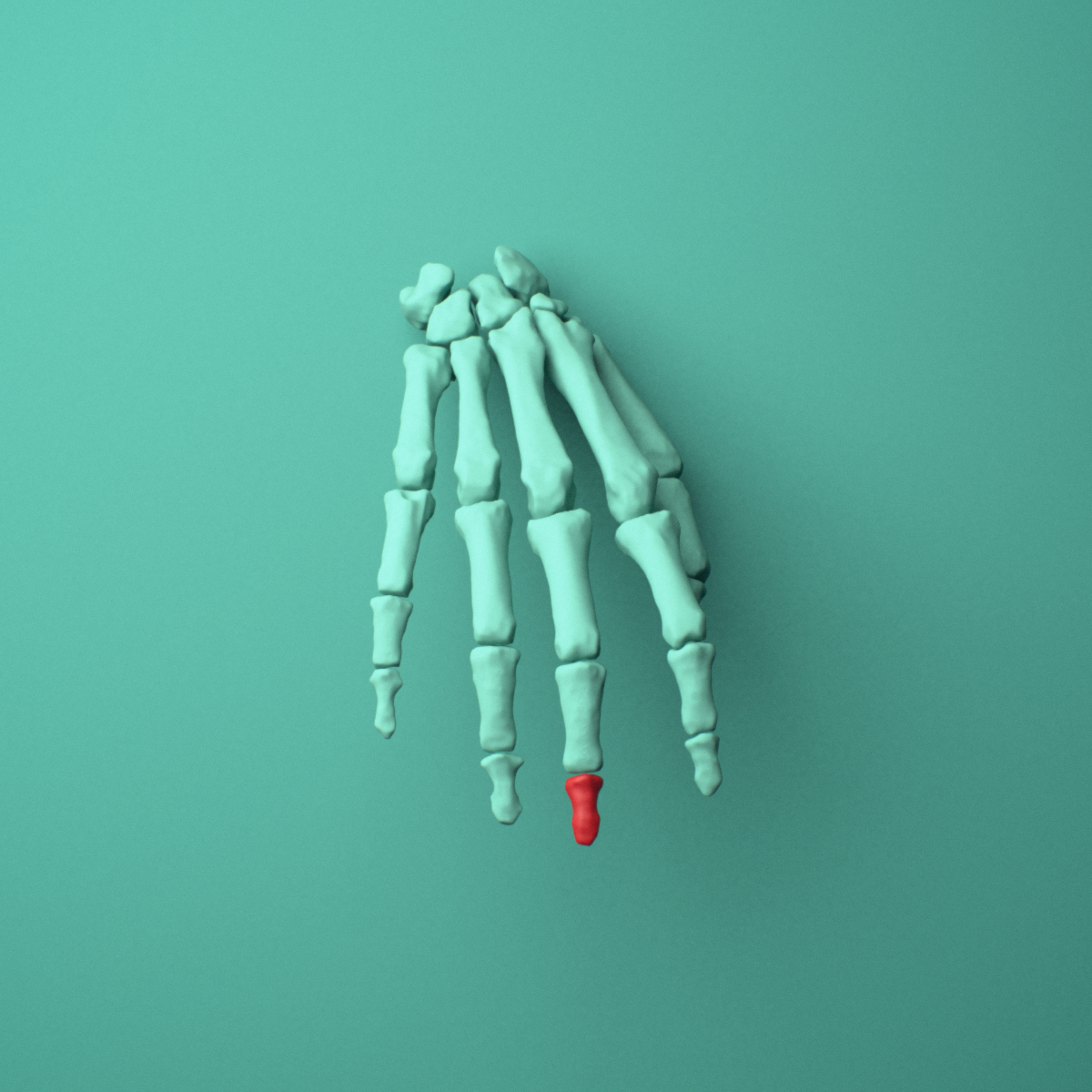 3D model of the Right middle finger distal phalanx shown in position within a full hand and wrist model, anterior view.
