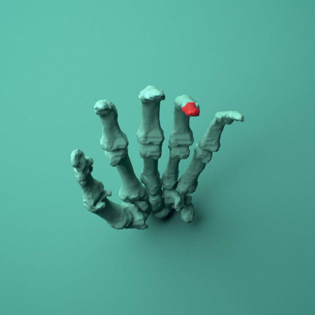 3D model of the Left ring finger distal phalanx shown in position within a full hand and wrist model, inferior view.
