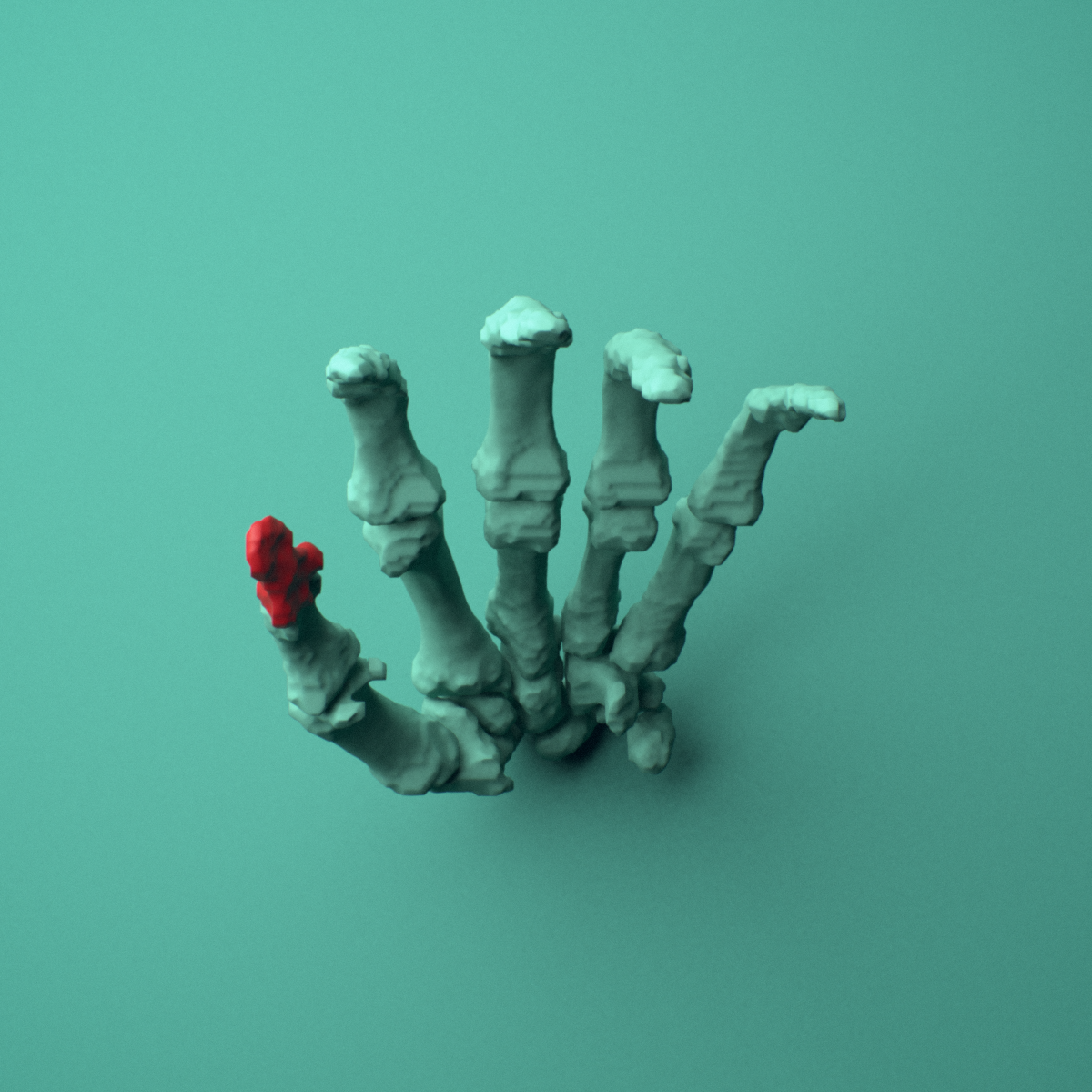 3D model of the Left thumb distal phalanx shown in position within a full hand and wrist model, inferior view.