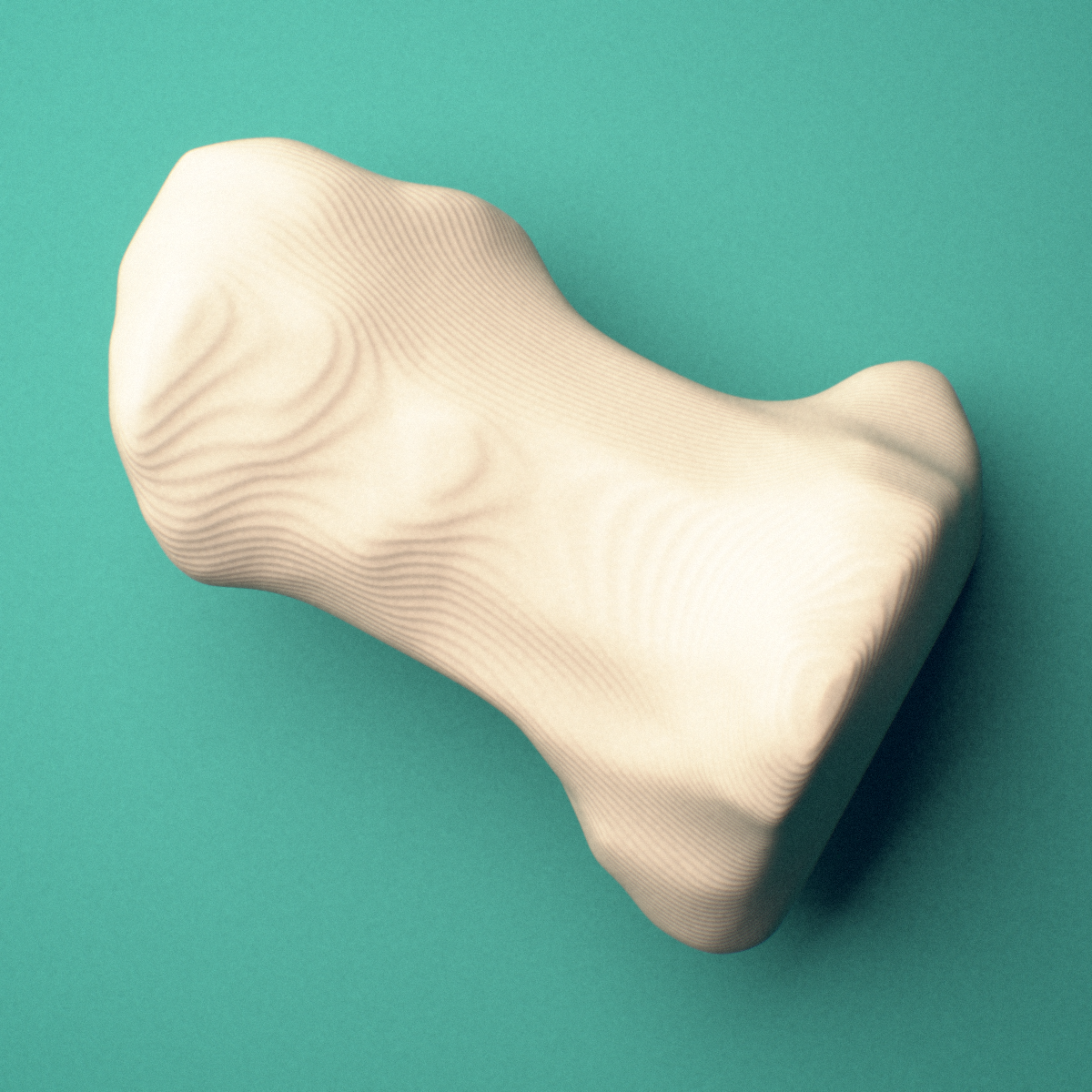 3D-printed Right thumb distal phalanx, oblique view showing the base and head (trochlea).