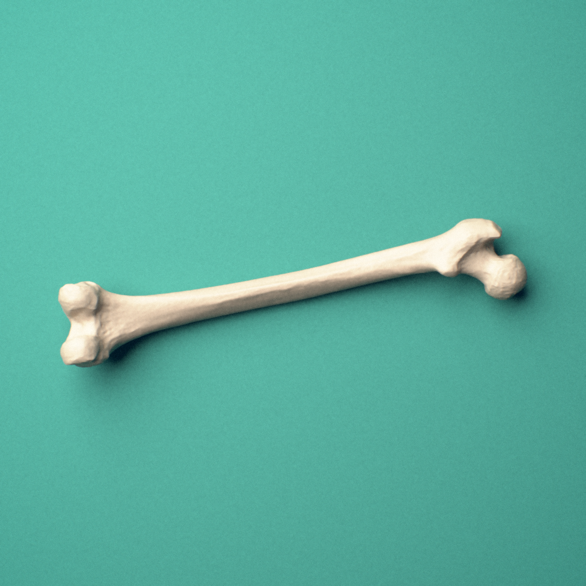 3D-printed Left femur (thigh bone), oblique close-up view showing the femoral head and greater trochanter.