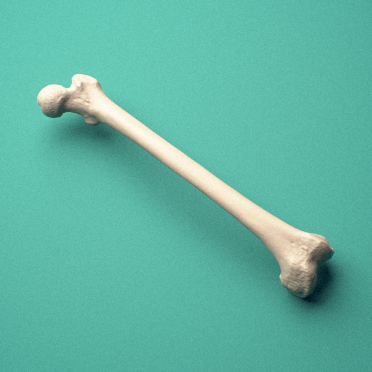 3D-printed Left femur (thigh bone), oblique close-up view showing the medial and lateral condyles.