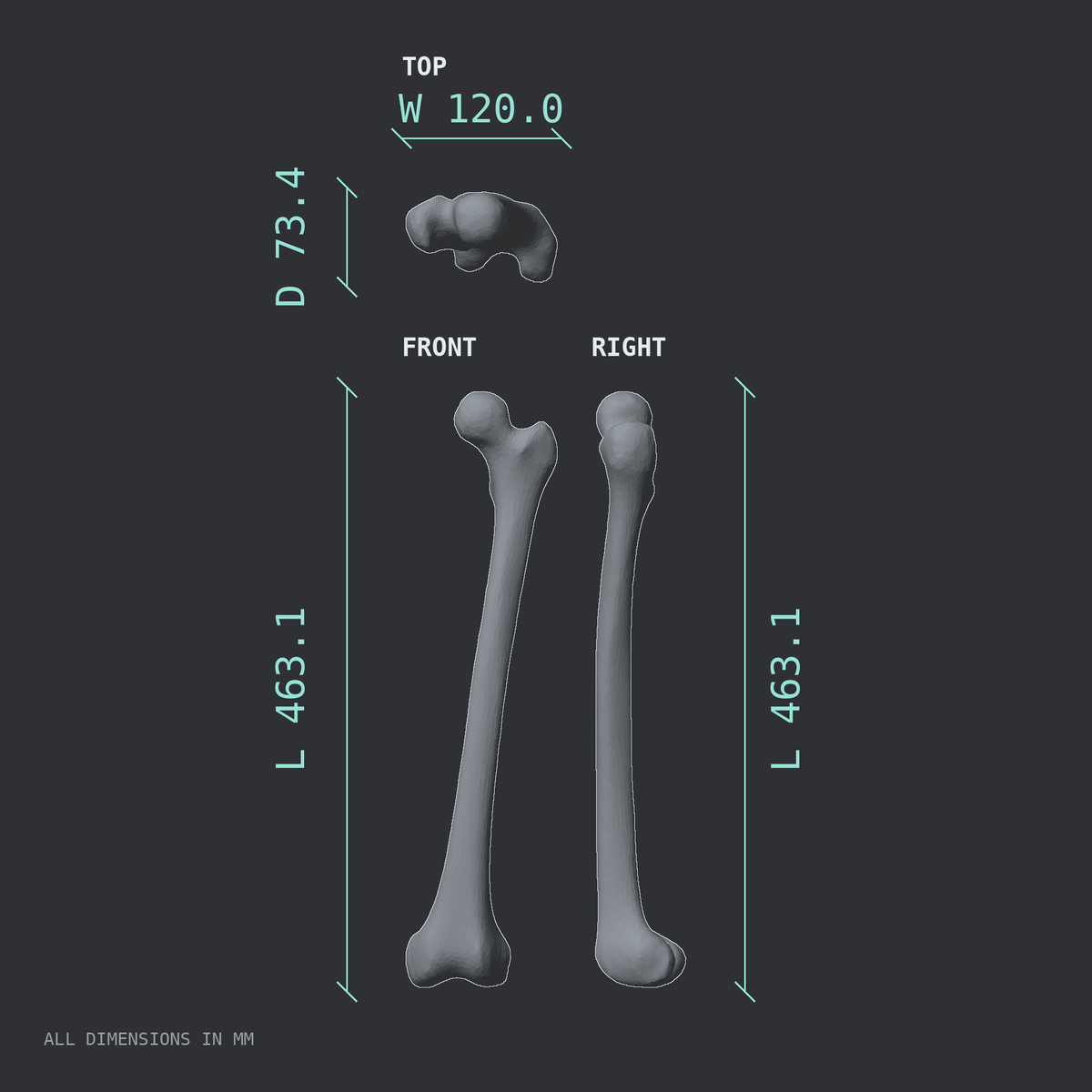 3D rendered dimensional drawing of the Left femur (thigh bone), top, front, and side views.
