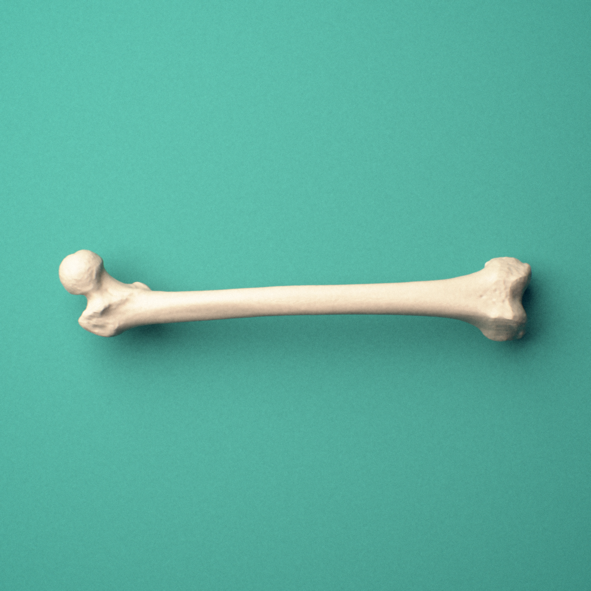 3D-printed Right femur (thigh bone), oblique view showing the femoral head and greater trochanter and medial and lateral condyles.