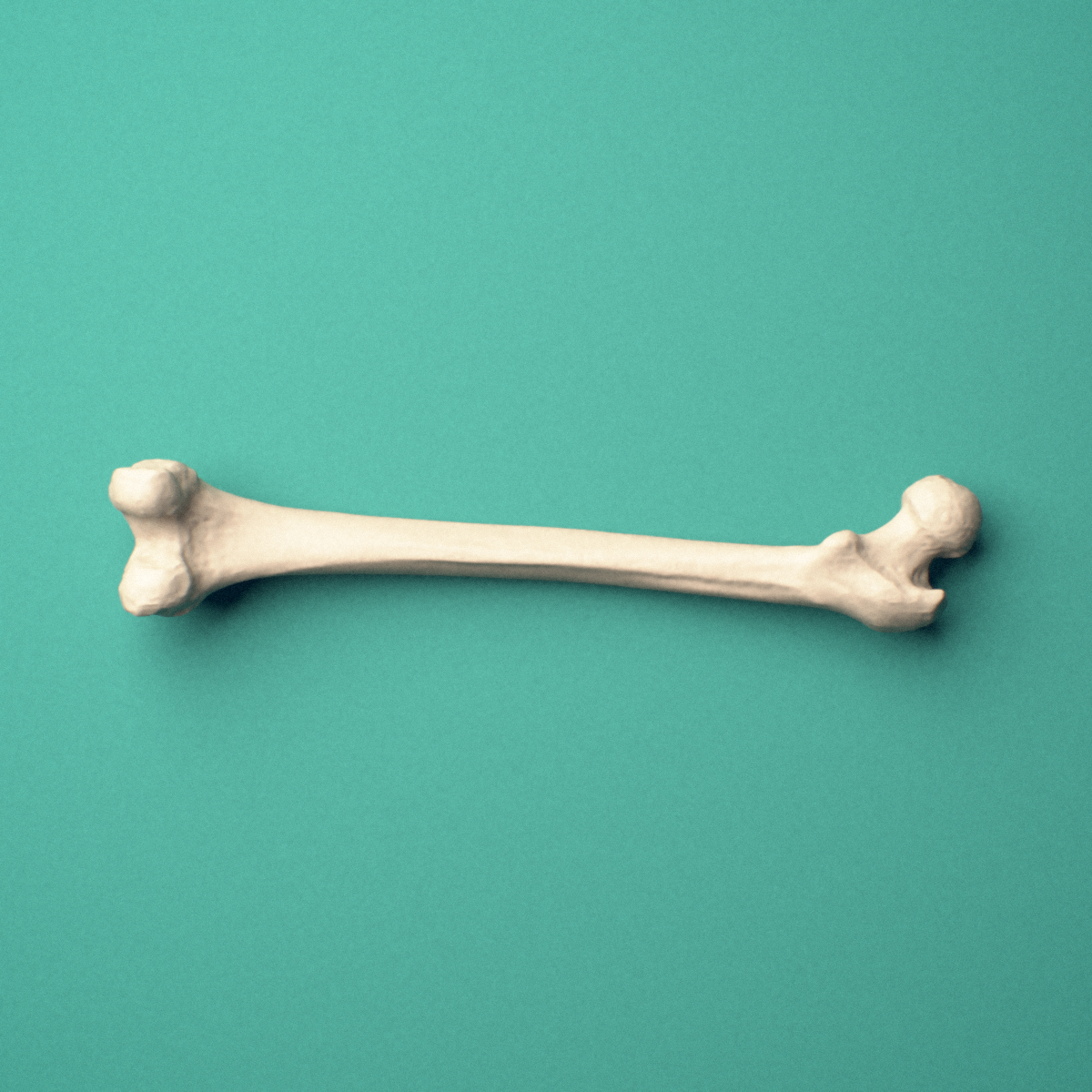 3D-printed Right femur (thigh bone), oblique close-up view showing the femoral head and greater trochanter.