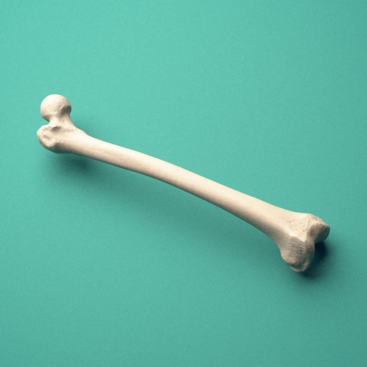 3D-printed Right femur (thigh bone), oblique close-up view showing the medial and lateral condyles.