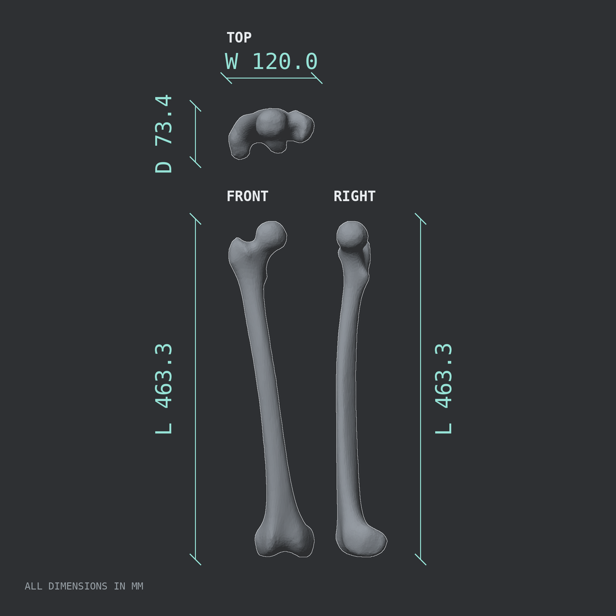 3D rendered dimensional drawing of the Right femur (thigh bone), top, front, and side views.