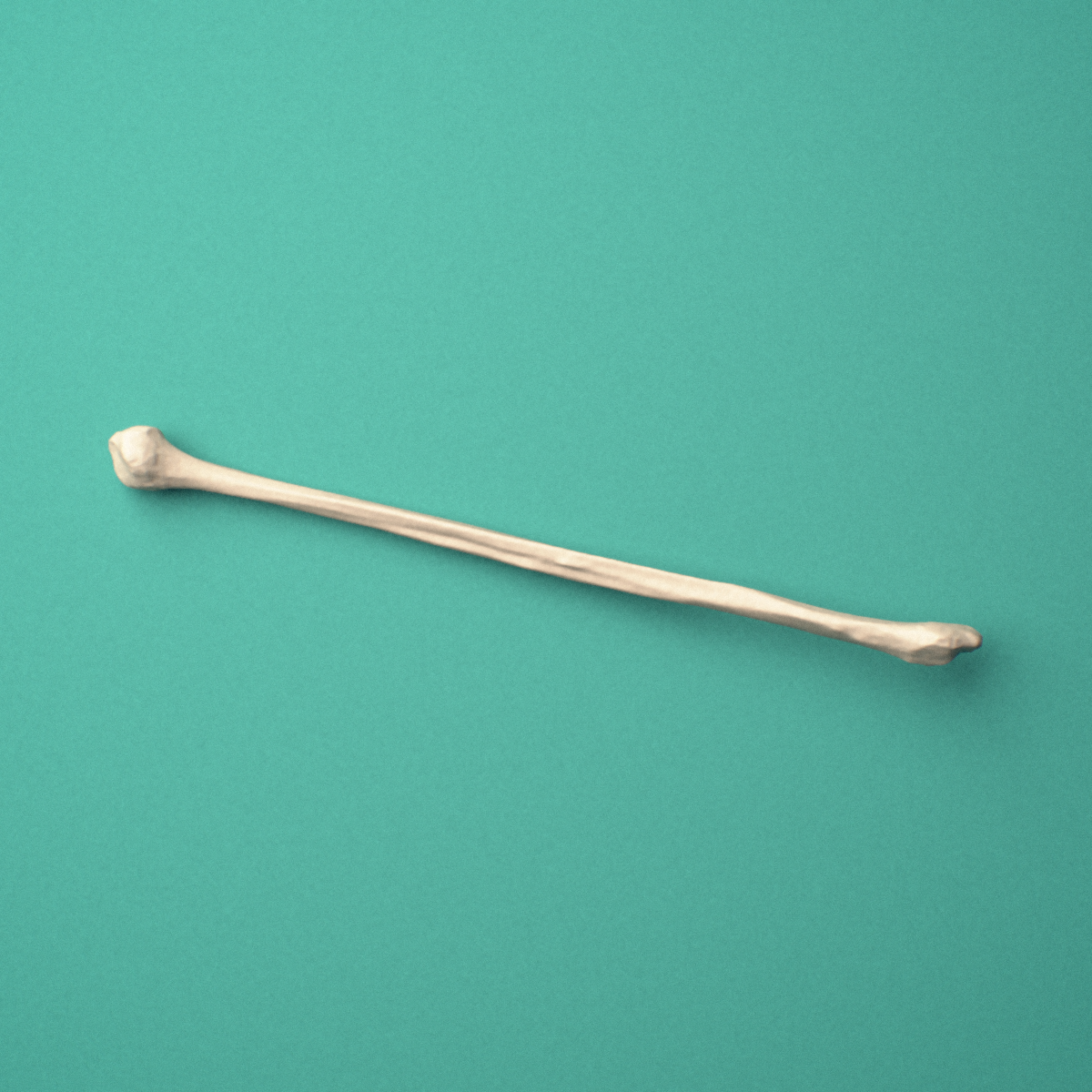 3D-printed Left fibula, oblique view showing the fibular head and lateral malleolus.