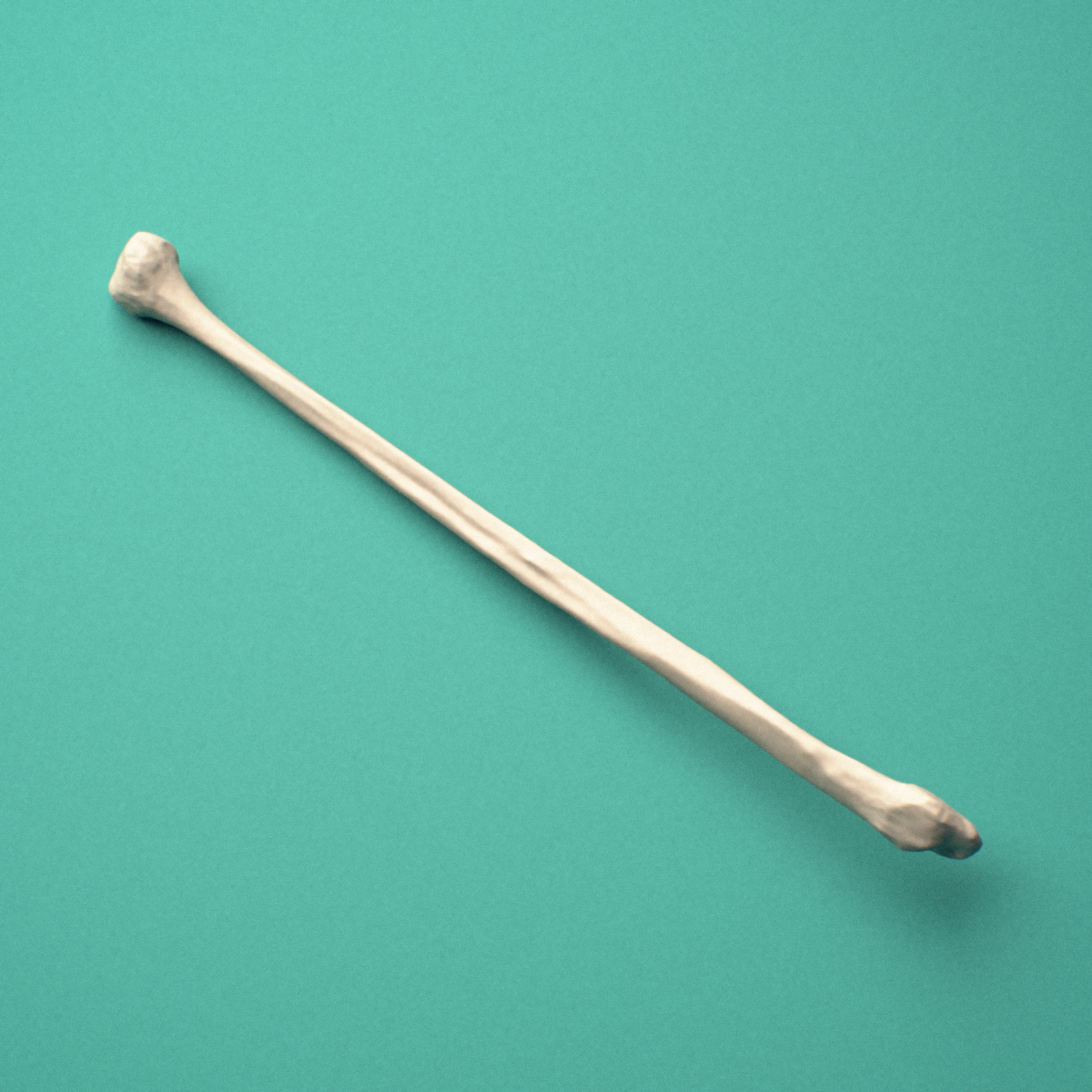 3D-printed Left fibula, oblique close-up view showing the lateral malleolus.
