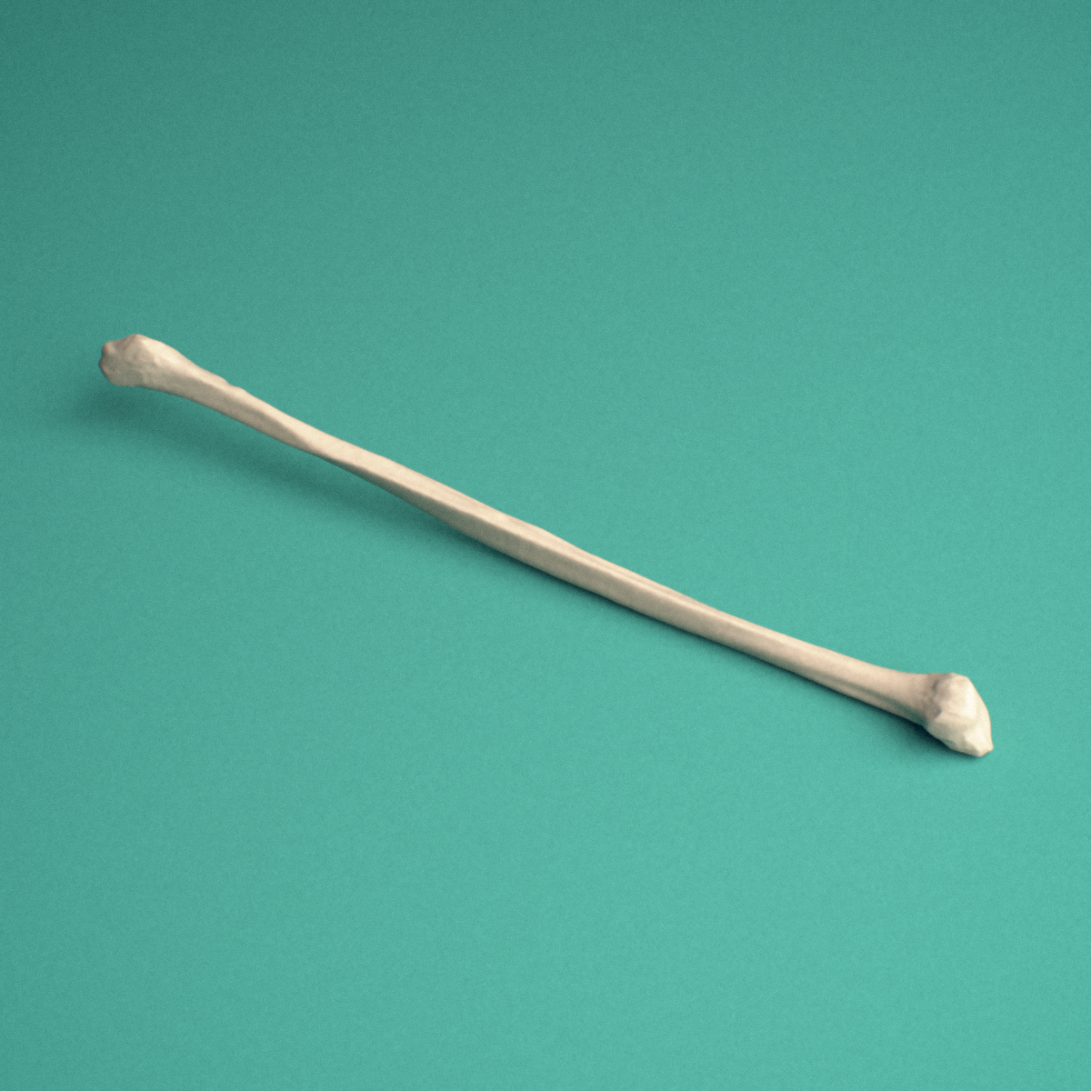 3D-printed Left fibula, lateral view showing the shaft and shaft.