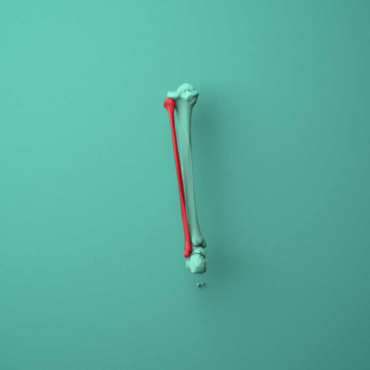 3D model of the Left fibula shown in position within a full knee and lower leg model, posterior view.