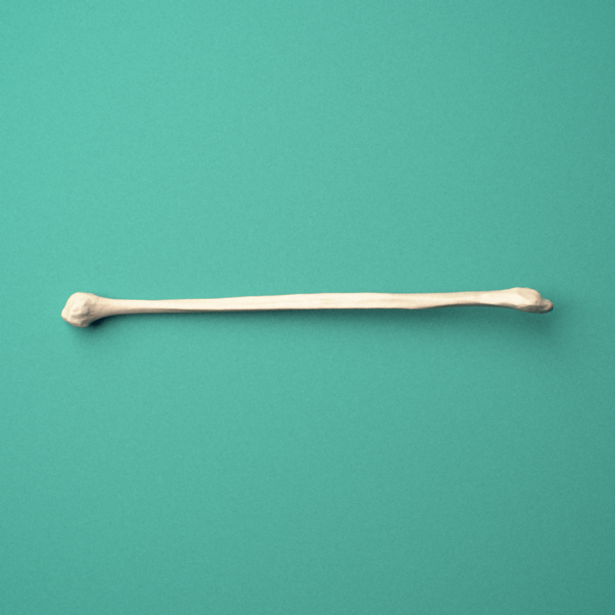 3D-printed Right fibula, oblique view showing the fibular head and lateral malleolus.